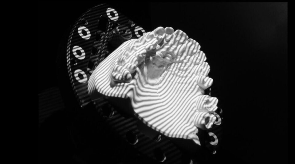 CAD/CAM basierter Abdruck