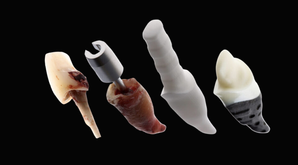 CAD/CAM implant -root analogue implants